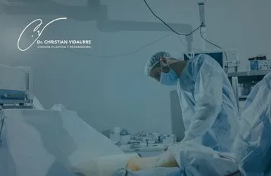 Recuperación de una abdominoplastia: qué esperar semana a semana